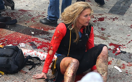 The Exact same problem. No blood or broken skin with the shredded costuming. I'm glad she's ok. 