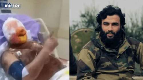 "Abu Homs" before and after he was wounded. 