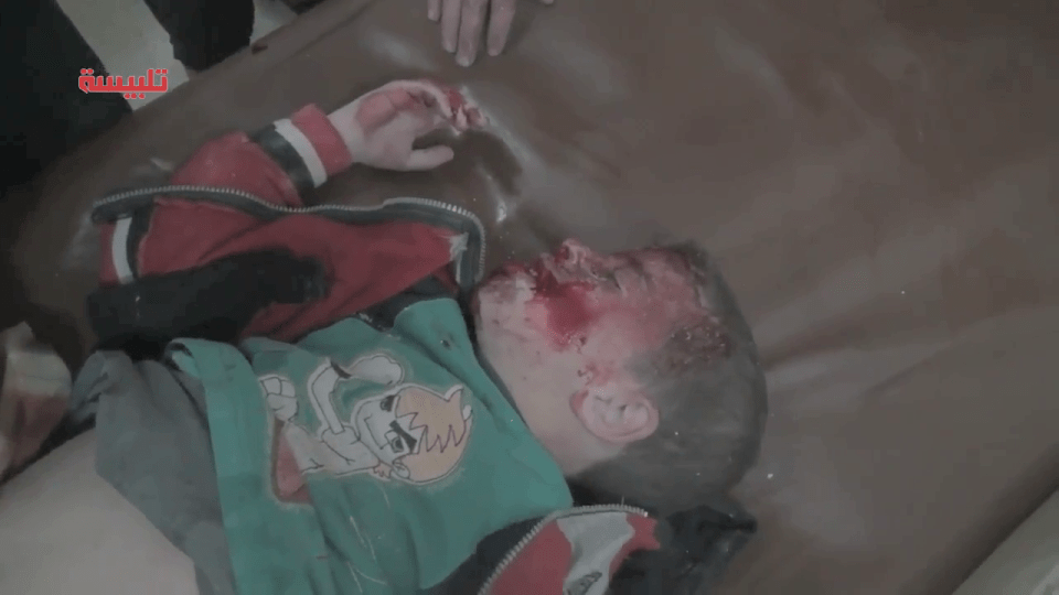 Child wounded by Syrian/Russian strike is tended to in an Idlib field hospital. January 2016.